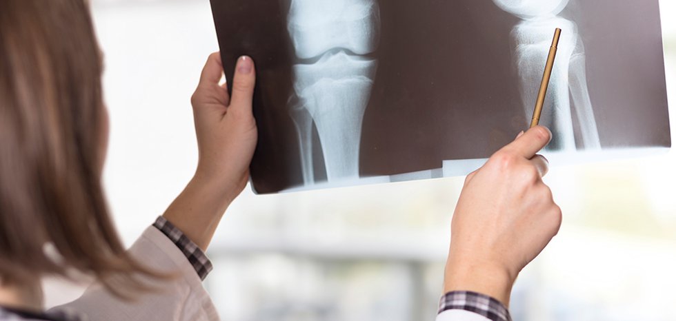 The Importance of Bone Health in Advanced Cancer